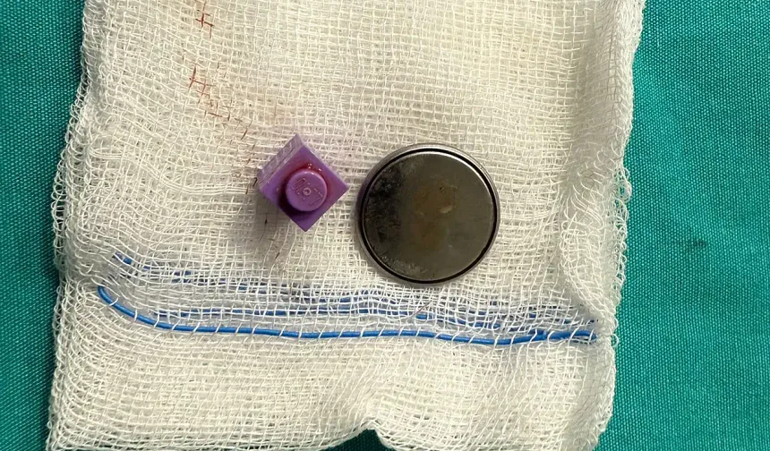 Kayseri’de minik A.Y.Ç.’nin tehlikeli yutkunması ameliyatla sonuçlandı